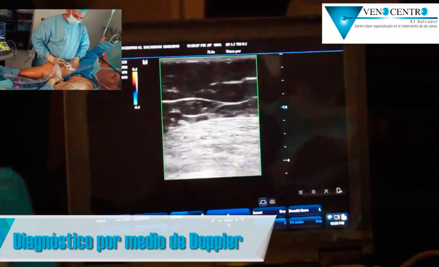 Evaluación con Doppler y Vein Viewer